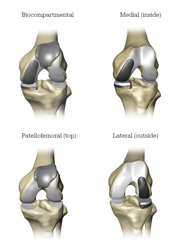 Knee bone joint diagram